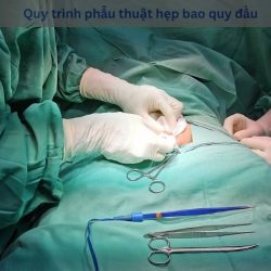 https://phongkhamvietsing.vn/wp-content/uploads/2024/07/Quy-trinh-phau-thuat-hep-bao-quy-dau-250x250.jpg