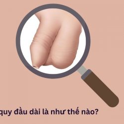 https://phongkhamvietsing.vn/wp-content/uploads/2024/07/bao-quy-dau-dai-la-nhu-the-nao-250x250.jpg