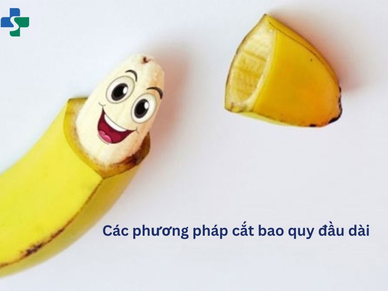 Các phương pháp cắt bao quy đầu dài