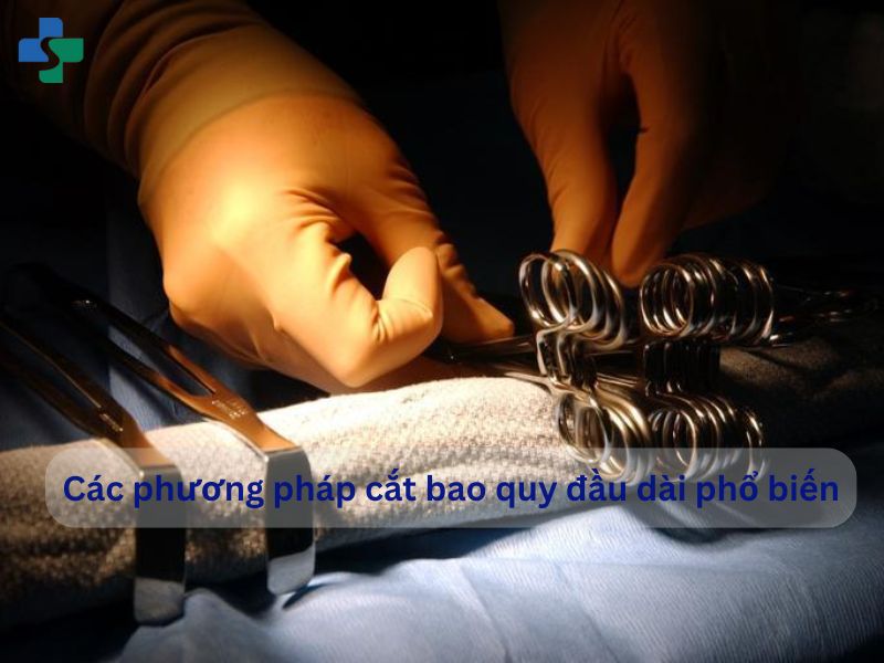 Các phương pháp cắt bao quy đầu dài phổ biến hiện nay 