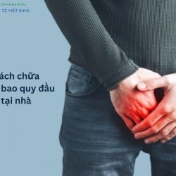 https://phongkhamvietsing.vn/wp-content/uploads/2024/07/cach-chua-viem-bao-quy-dau-tai-nha-250x250.jpg