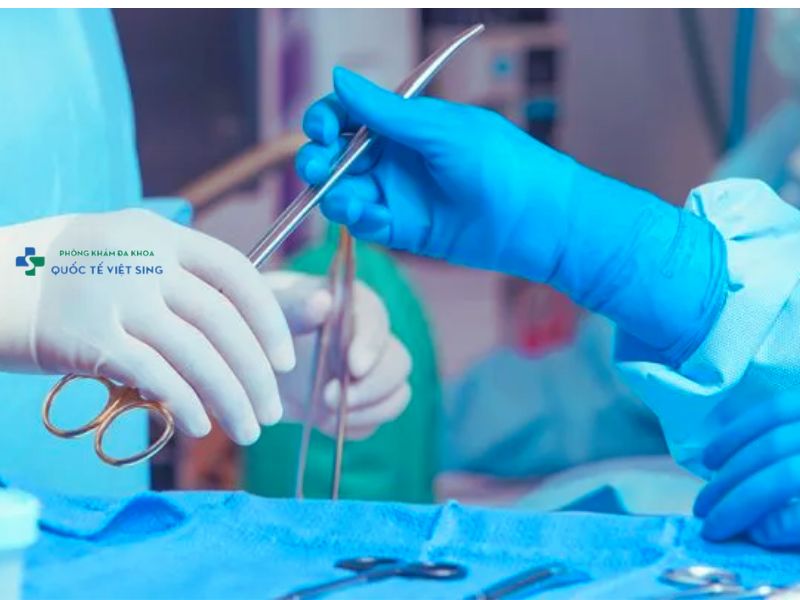 Can thiệp ngoại khoa chữa viêm bao quy đầu
