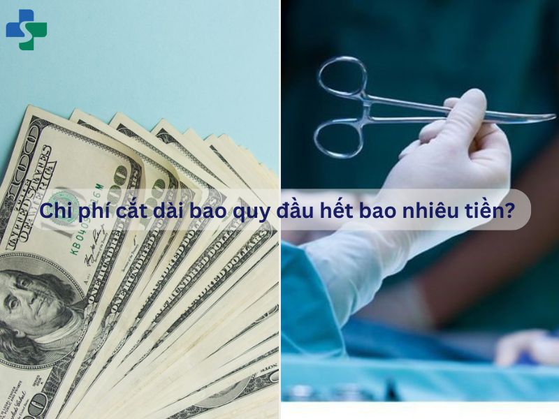 Chi phí cắt bao quy đầu dài hết bao nhiêu tiền?