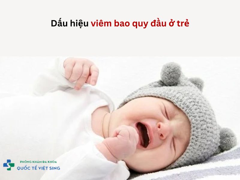 dấu hiệu viêm bao quy đầu ở trẻ em