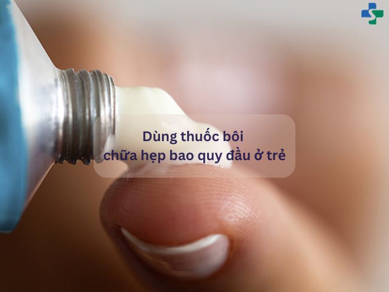 Dùng thuốc bôi chữa hẹp bao quy đầu ở trẻ