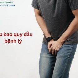 https://phongkhamvietsing.vn/wp-content/uploads/2024/07/hep-bao-quy-dau-benh-ly-250x250.jpg
