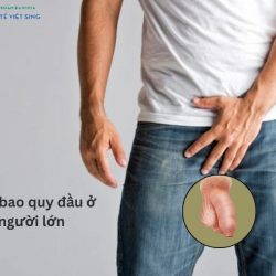 https://phongkhamvietsing.vn/wp-content/uploads/2024/07/hep-bao-quy-dau-nguoi-lon-2-250x250.jpg