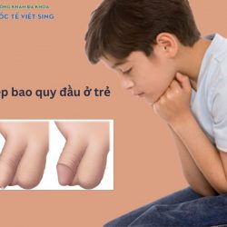 https://phongkhamvietsing.vn/wp-content/uploads/2024/07/hep-bao-quy-dau-o-tre-250x250.jpg