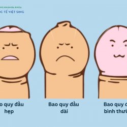 https://phongkhamvietsing.vn/wp-content/uploads/2024/07/mac-benh-ly-tai-bao-quy-dau-250x250.jpg