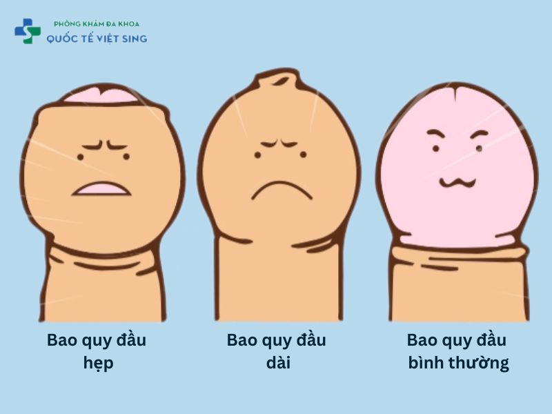 Mắc các bệnh lý tại bao quy đầu