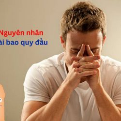 https://phongkhamvietsing.vn/wp-content/uploads/2024/07/nguyen-nhan-dai-bao-quy-dau-250x250.jpg