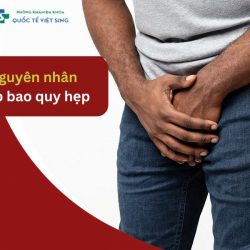 https://phongkhamvietsing.vn/wp-content/uploads/2024/07/nguyen-nhan-hep-bao-quy-dau-2-250x250.jpg