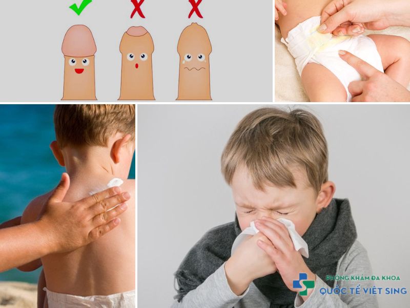 Nguyên nhân gây viêm bao quy đầu ở trẻ