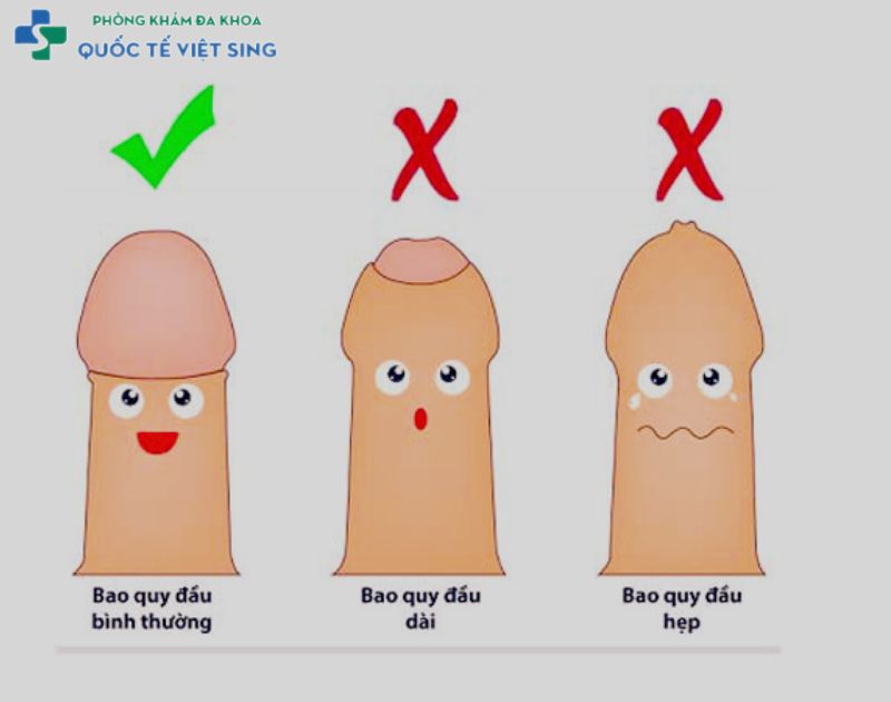 Viêm bao quy đầu và nguyên nhân gây bệnh 