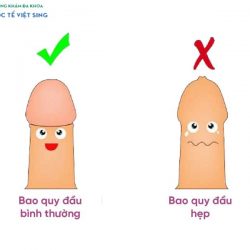 https://phongkhamvietsing.vn/wp-content/uploads/2024/07/phan-biet-baoquy-dau-hep-250x250.jpg