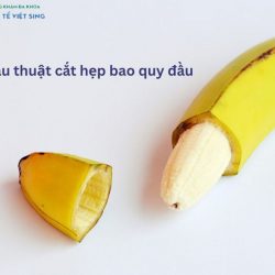 https://phongkhamvietsing.vn/wp-content/uploads/2024/07/phau-thuat-cat-hep-bao-quy-dau-2-250x250.jpg
