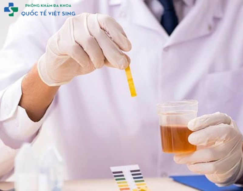 phương pháp Chẩn đoán tình trạng viêm ở bao quy đầu