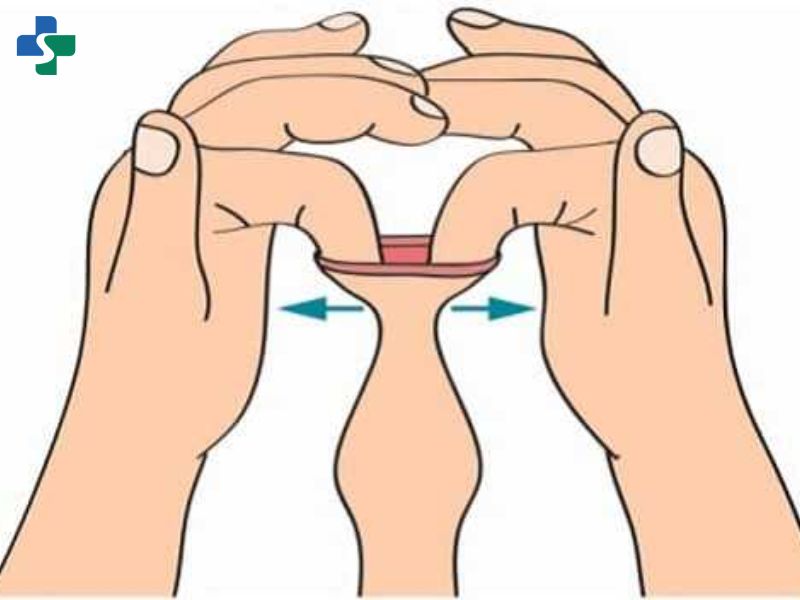 Thực hiện tuột bao quy đầu đúng cách 
