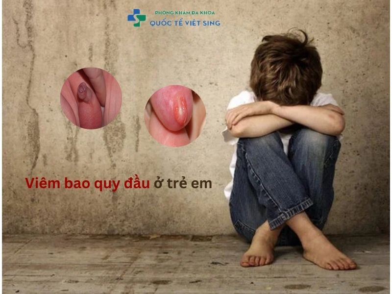 tìm hiểu Viêm bao quy đầu ở trẻ em