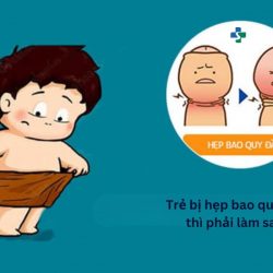 https://phongkhamvietsing.vn/wp-content/uploads/2024/07/tre-bi-hep-bao-quy-dau-phai-lam-sao-250x250.jpg
