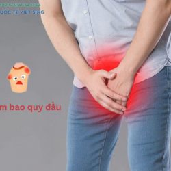 https://phongkhamvietsing.vn/wp-content/uploads/2024/07/viem-bao-quy-dau-250x250.jpg