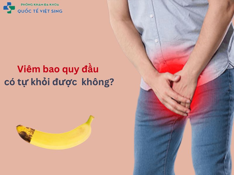 Viêm bao quy đầu có tự khỏi không?