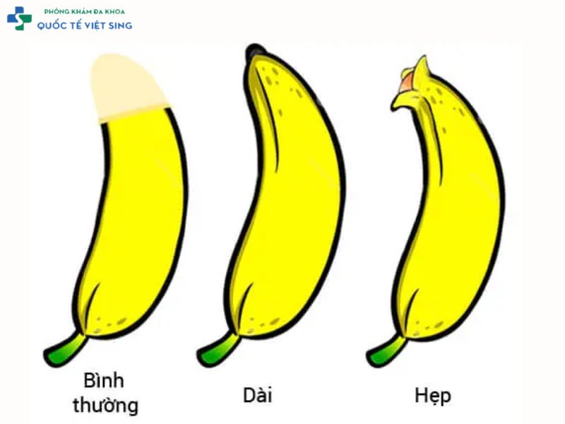 viêm bao quy đầu do cấu tạo cơ quan sinh dục 