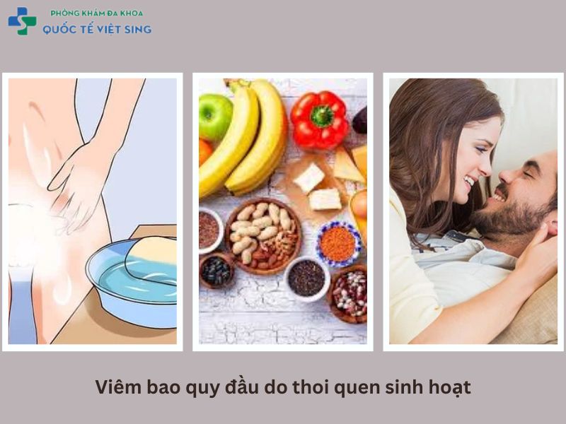 Viêm bao quy đầu do Thói quen sinh hoạt