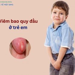 https://phongkhamvietsing.vn/wp-content/uploads/2024/07/viem-bao-quy-dau-o-tre-250x250.jpg