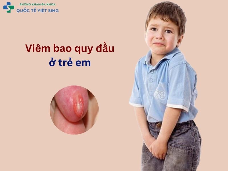 Viêm bao quy đầu ở trẻ em