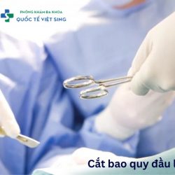 https://phongkhamvietsing.vn/wp-content/uploads/2024/08/cat-bao-quy-dau-la-gi-250x250.jpg