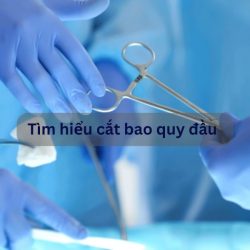 https://phongkhamvietsing.vn/wp-content/uploads/2024/08/tim-hieu-cat-bao-quy-dau-250x250.jpg