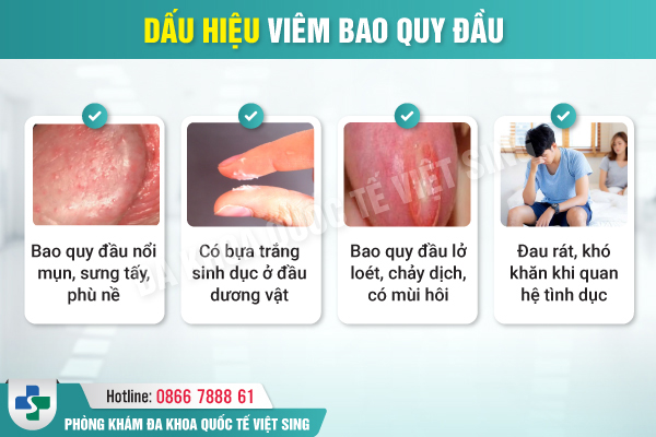 https://phongkhamvietsing.vn/wp-content/uploads/2025/03/80.jpg