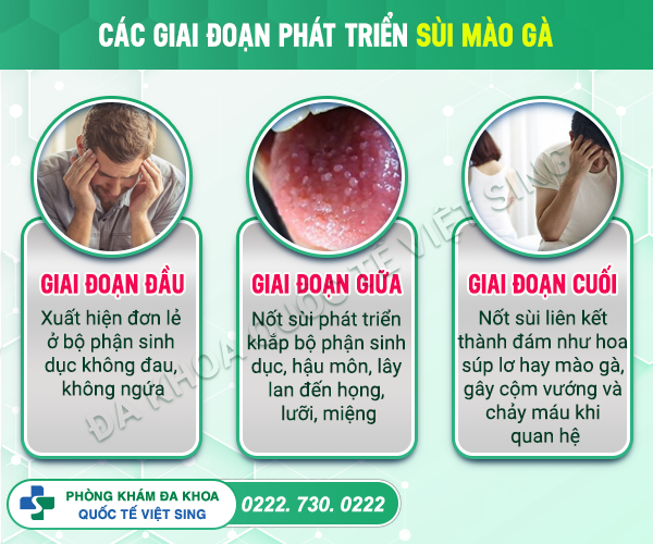 [BÁO ĐỘNG NGUY HIỂM] Đừng coi thường dấu hiệu mụn thịt âm đạo!